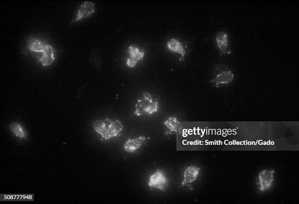 This photomicrograph depicts a positive indirect fluorescent antibody test for Giardia lamblia parasites. Image courtesy CDC/Dr. Govinda S....