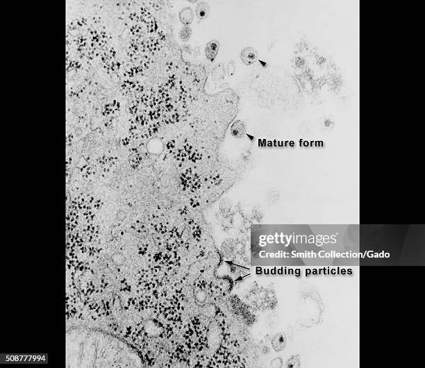 This transmission electron micrograph depicts HIV-1 budding and free virions. Image courtesy CDC/Alyne Harrison, Erskine Palmer, Paul Feorino, 1984. .