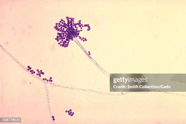 Phialoconidia of Aspergillus fumigatus. Image courtesy CDC. 1982. .