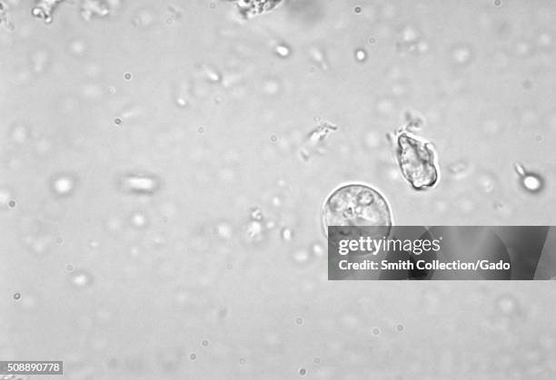 This unstained photomicrograph depicts a cyst of an Entamoeba histolytica amoebic parasite, displaying a visible chromatoid body. Image courtesy...