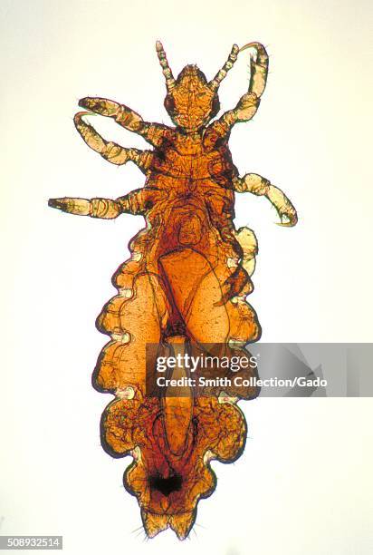 This image depicts a dorsal view of a female head louse, Pediculus humanus var. Capitis. Lice are parasitic insects that can be found on people's...
