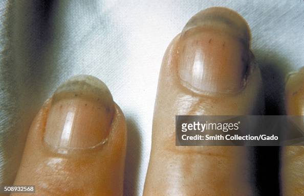 66,806 Nails Photos and Premium High Res Pictures - Getty Images
