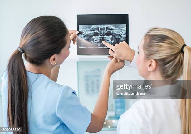 zahnärzte, die zahnröntgen - abszess stock-fotos und bilder