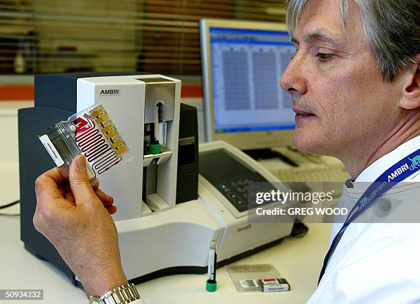 Scientist Dr Bruce Cornell holds a blood sample alongside the world's first digital whole blood biosensor, the "SensiDx" , a bionanotechnology system...