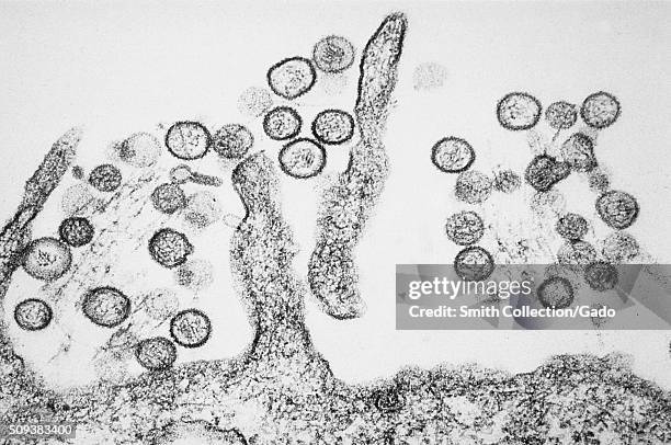 Transmission electron micrograph of the Sin Nombre Hantavirus. Hantaviruses that cause Hantavirus pulmonary syndrome are carried in rodent droppings,...