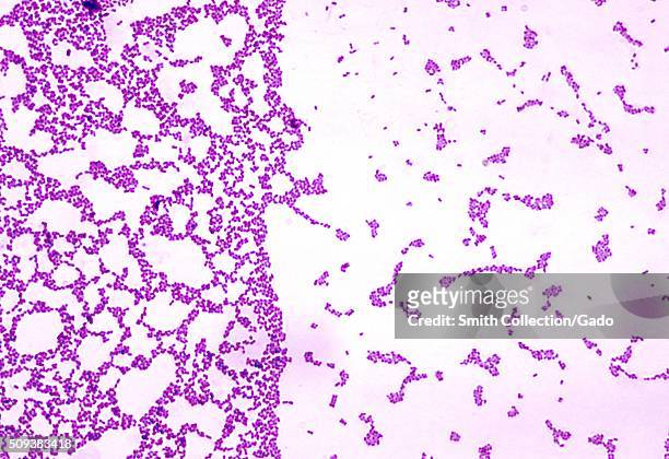 Photomicrograph of Streptococcus mutans bacteria using Gram stain technique. Blood agar plate culture yields coccal-like morphology without chains....