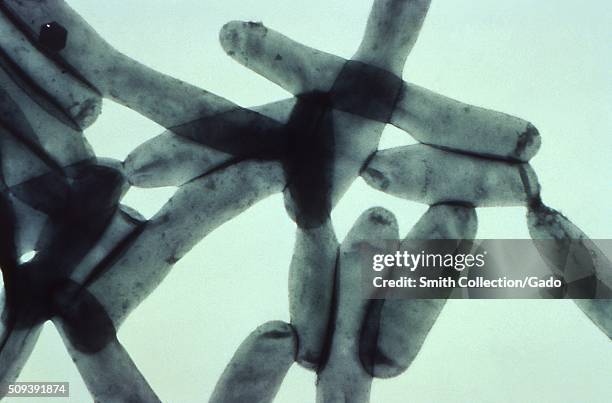 Under a magnification of 43,700X, this transmission electron micrograph created from a whole preparation of Legionella pneumophila bacteria that had...