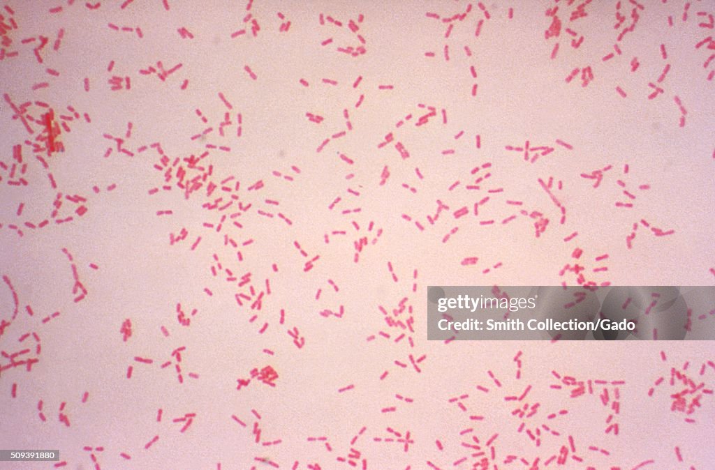 Alcaligenes faecalis. Gram stain. Image courtesy CDC/Dr. W.A. Clark