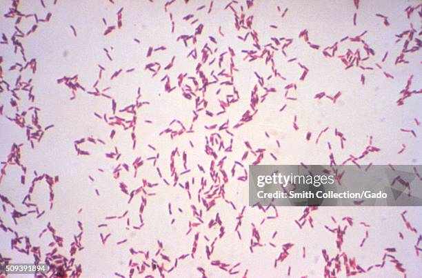Actinomyces viscosus. Gram stain. Image courtesy CDC/Dr. W.A. Clark, 1977. .