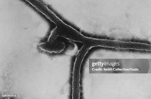This transmission electron micrograph revealed some of the ultrastructural morphology exhibited by the Marburg virus, the cause of Marburg...