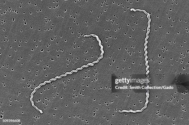 Scanning electron micrograph of Leptospira interrogans strain RGA. Two spirochetes bound to a 0.2 µm filter. Strain RGA was isolated in 1915 by...