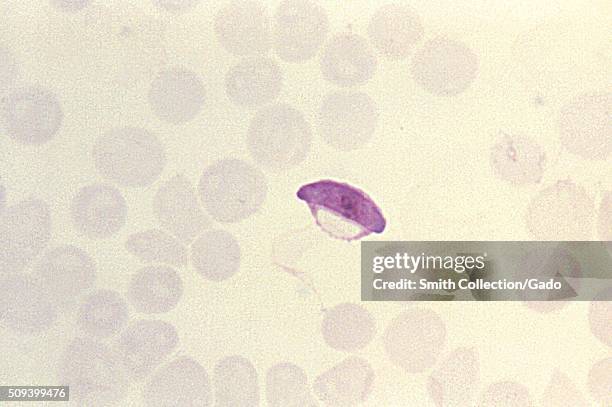 This thin film Giemsa-stained micrograph depicts a parasitic Plasmodium falciparum microgametocyte. Infection with one type of malaria, P....