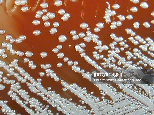 Burkholderia pseudomallei grown on sheep blood agar for 48 hours. Burkholderia pseudomallei is a Gram-negative aerobic bacteria, and is the causative...