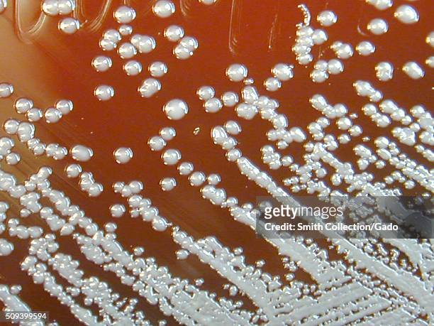 Burkholderia pseudomallei grown on sheep blood agar for 48 hours. Burkholderia pseudomallei is a Gram-negative aerobic bacteria, and is the causative...