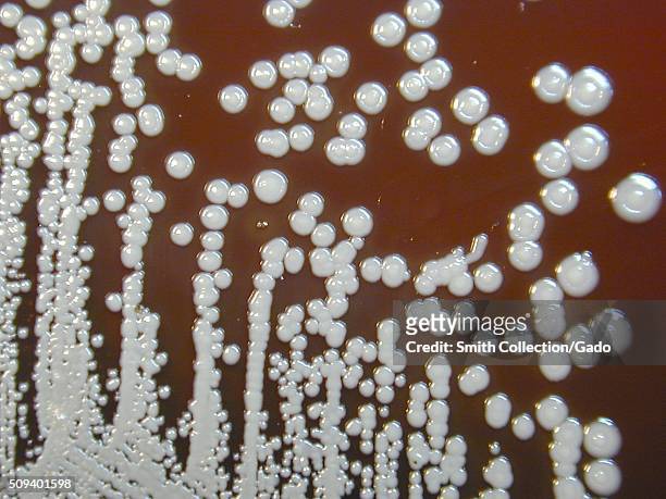 Burkholderia pseudomallei grown on sheep blood agar for 72 hours. Burkholderia pseudomallei is a Gram-negative aerobic bacteria, and is the causative...