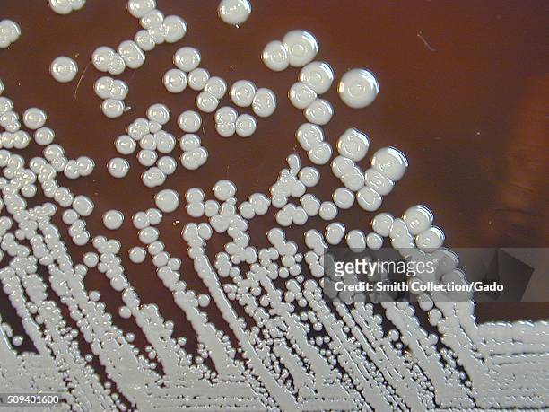 Burkholderia pseudomallei grown on sheep blood agar for 96 hours. Burkholderia pseudomallei is a Gram-negative aerobic bacteria, and is the causative...