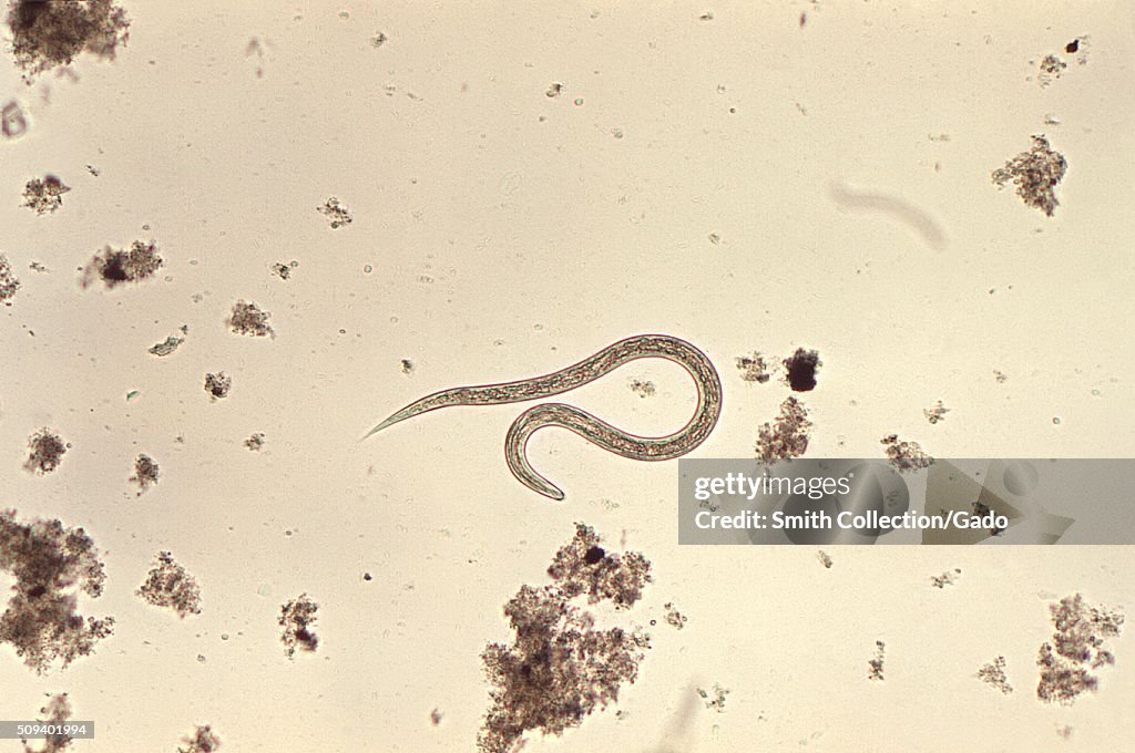 Hookworm filariform larva