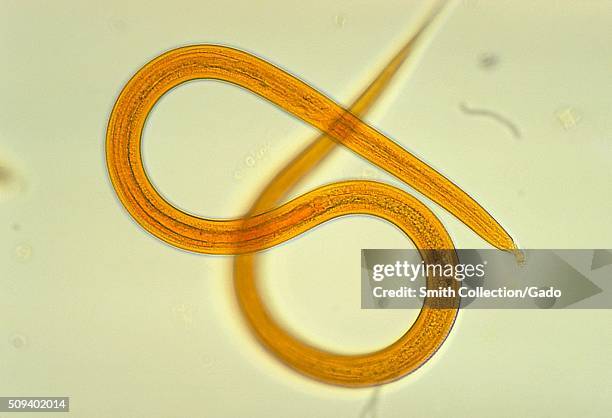 Strongyloides filariform larva. Roundworm, nematode, parasite. Image courtesy CDC/Dr. Mae Melvin, 1974. .