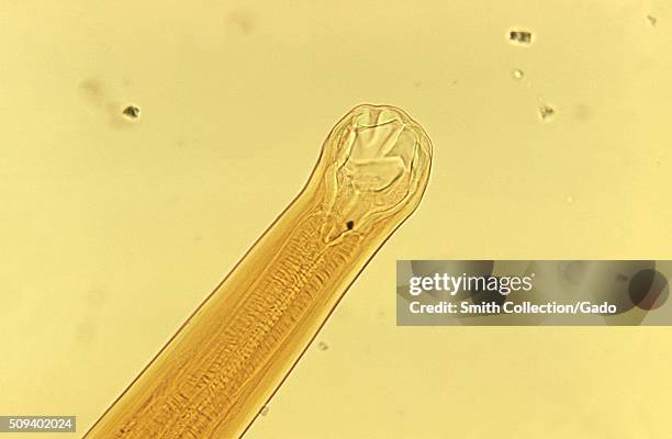 Ancylostoma braziliense mouth parts. Ancylostoma braziliense mouth parts. Hookworm, parasite. Image courtesy CDC/Dr. Mae Melvin, 1973. .