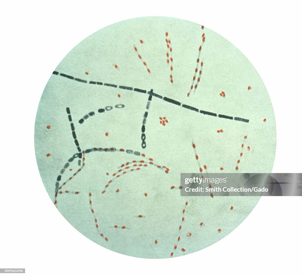 Bacillus Anthracis From Agar