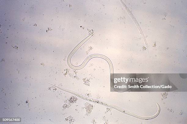 Under a magnification of 128X, this photomicrograph reveals ultrastructural details displayed a parasitic nematode , Strongyloides stercoralis, which...