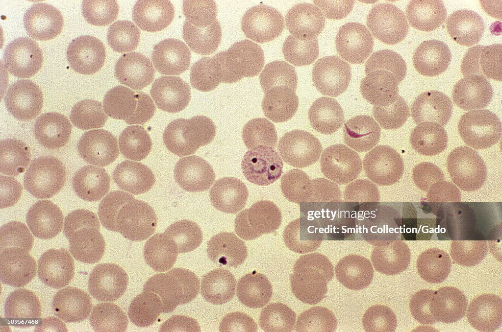 P. vivax ring forms