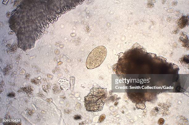 Magnified 128X, this photomicrograph revealed the presence of a trematode, Fasciola hepatica, or 'sheep liver fluke', egg, which is described as...