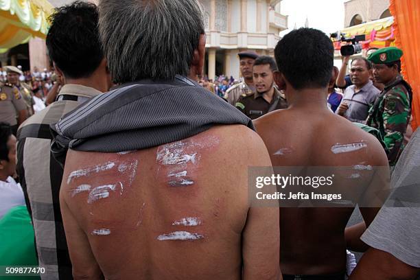 The injureies of a whipped person are treated with salve during the whipping punishment in front of public at Meulaboh on February 12, 2016 in West...