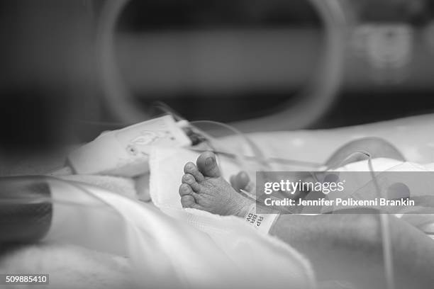 Premature newborn baby foot in the humidicrib in the Neonatal Intesive Care Unit on May 18, 2015 in Sydney, Australia. The Neonatal care unit at...