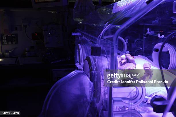 Premature newborn baby Alexander having Phototherapy in humidicrib in the Neonatal Intensive Care Unit at Royal Prince Alfred Hospital on May 20,...