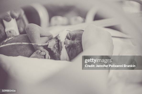 Humid Crib Premature newborn baby having ultrasound in humidicrib in the... News ...