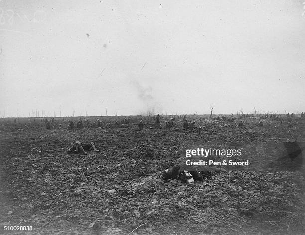 Casualties in No-Mans Land, France.