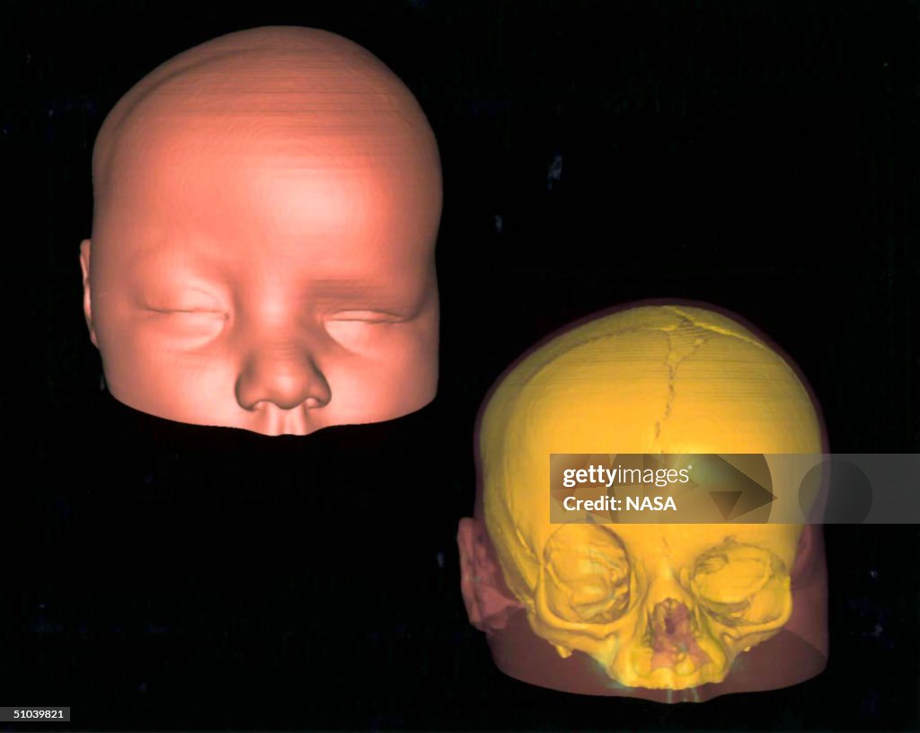 High Resolution Three Dimensional (3 D Image Displays A Computerised Visualization Of