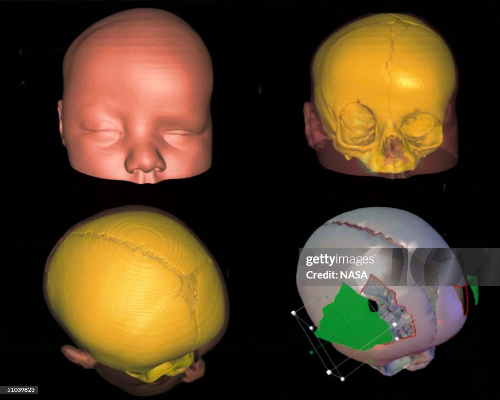 High Resolution Three Dimensional (3 D Image Displays A Computerised Visualization Of