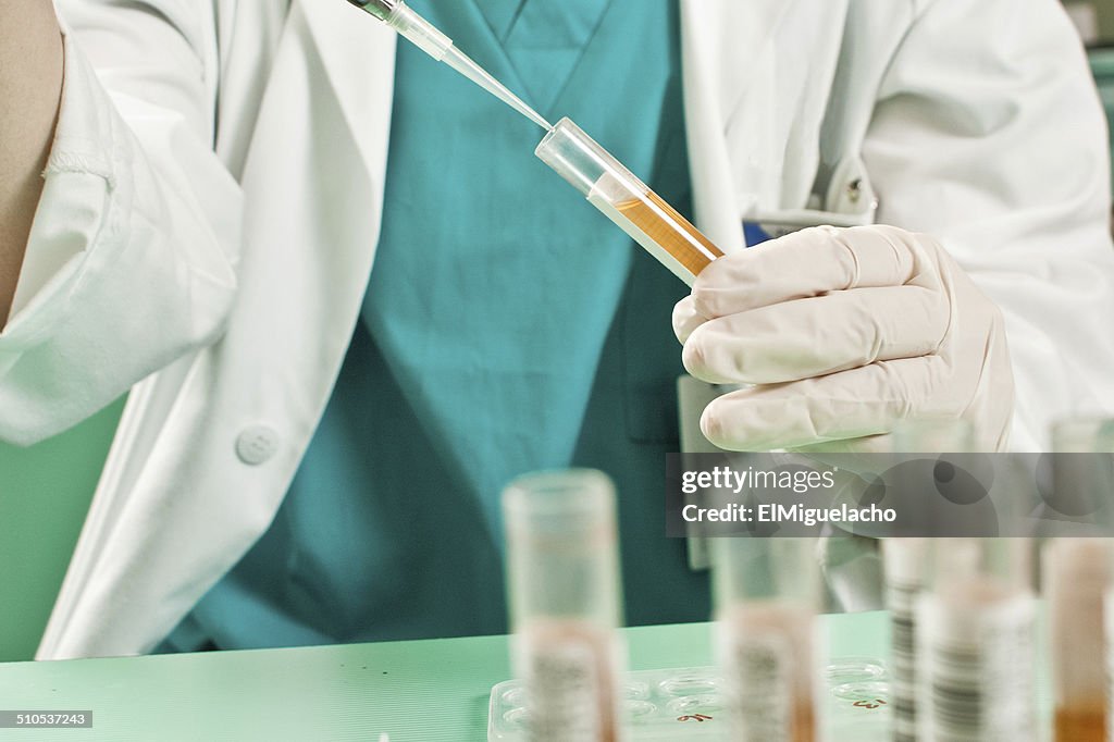Urine test