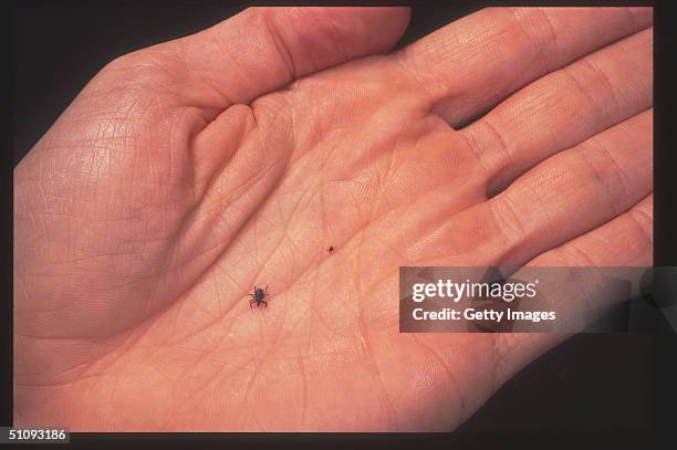 Close Up Of An Adult Female And Nymph Tick Is Shown June 15, 2001 In The Palm Of A Model's Hand. Ticks Cause An Acute Inflammatory Disease...