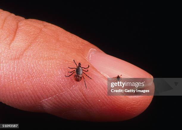 Close Up Of An Adult Female And Nymph Tick Is Shown June 15, 2001 On A Fingertip. Ticks Cause An Acute Inflammatory Disease Characterized By Skin...