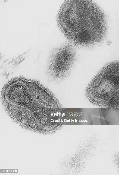 An Electron Micrograph Of The Smallpox Is Shown In This 1975 Photograph. Drug Company Aventis Pasteur Announced March 29, 2002 That It Would Donate...