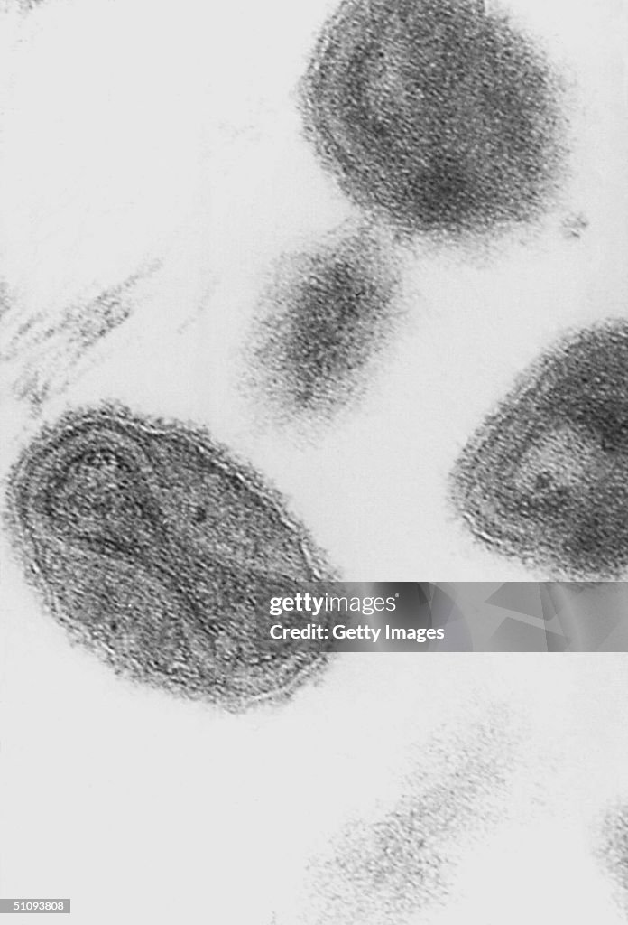 Smallpox In Humans An Electron Micrograph Of The Smallpox Is Shown In This 1975... News ...