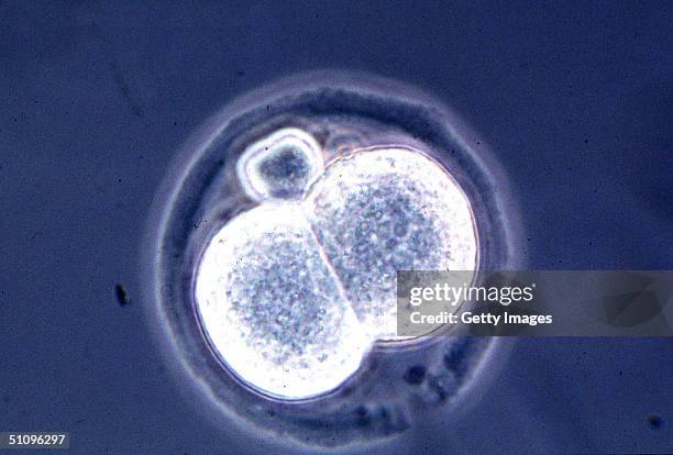 Microscopic View Of A Two Cell Mouse Embryo, A Result Of A New And Relatively Simple Cloning Technique Discovered By Scientists At The University Of...