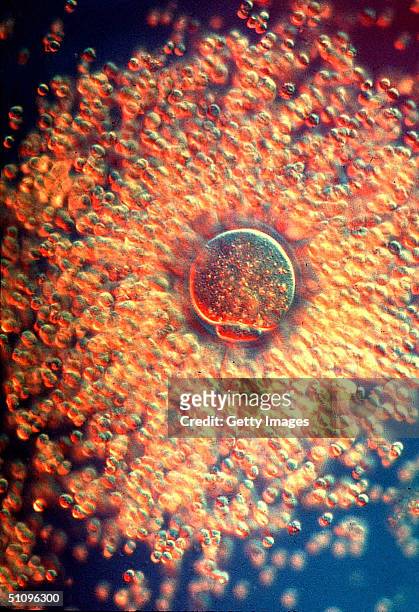 Thousands Of Adult Cumulous Cells Surrounding A Live Oocyte. Cumulous Cells Are Somatic Cells That Were The Source Of The Nuclei In The Cloning...