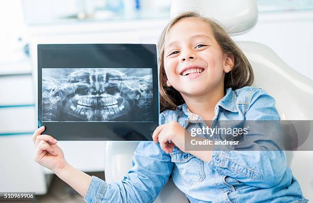 girl at the dentist holding an x-ray - menselijk gebit stockfoto's en -beelden