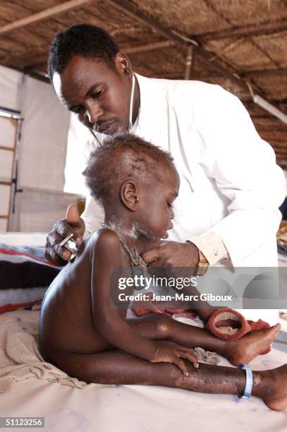 Severely malnourished child is tended to by Doctor Laouli Maman in the Medecins-sans-frontieres clinic December 4, 2003 in Maradi, Niger. The child...