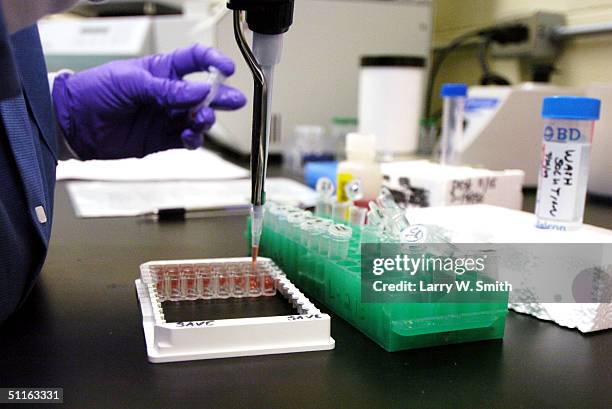 Cindy Chard-Bergstrom a Micro Biologist III at Kansas State University applies samples during a check test for Bovine Spongiform Encephalopathy , or...