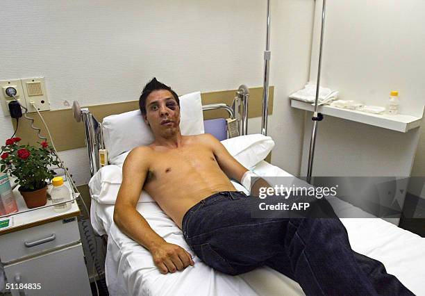 David Gros, 26 ans pose, le 15 aout 2004 dans sa chambre d'hopital a Marseille, ou il a ete accUeuilli apres avoir ete violemment agresse dans la...