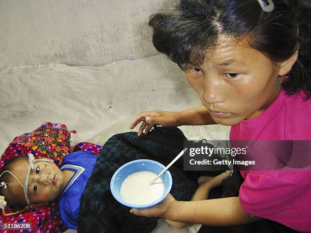 In this handout from the World Food Programme, a malnourished North Korean boy, 3 year-old Jong Song Chol, is fed a vitamin and mineral-enriched...