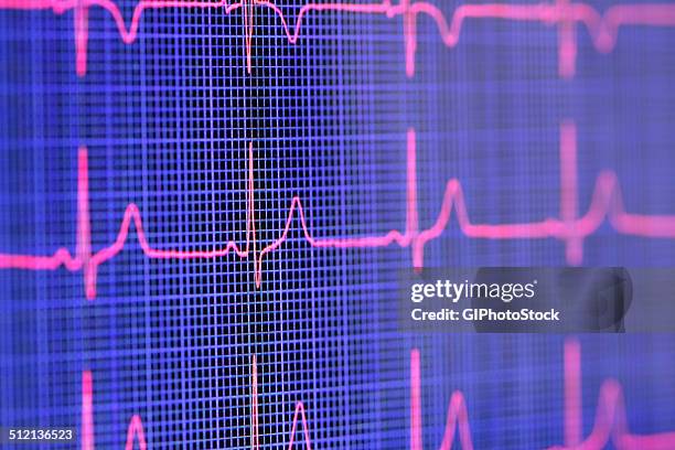 tablet computer screen displaying an electrocardiogram - heartbeat foto e immagini stock