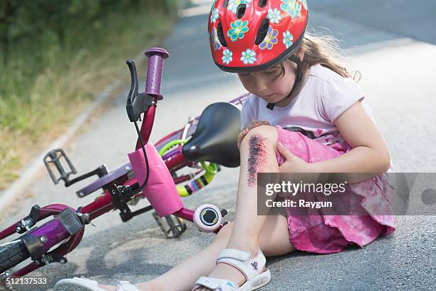 young girl with injured leg sitting on road with bicycle - injured knee stock pictures, royalty-free photos & images