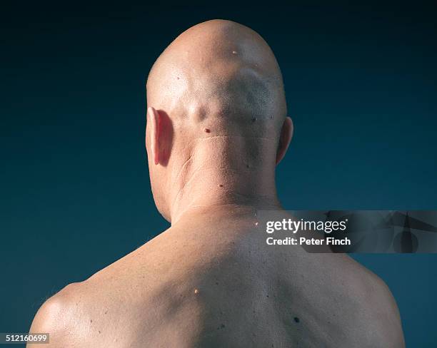 middle-aged man's back with moles - calvo fotografías e imágenes de stock
