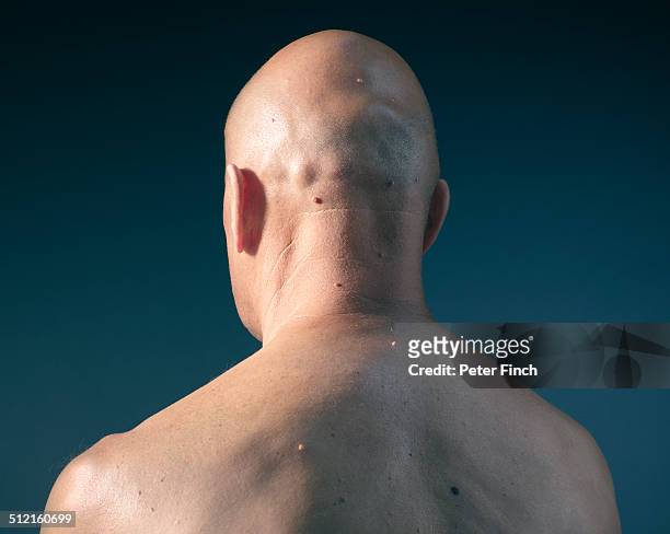 middle-aged man's back with moles - bald man stock pictures, royalty-free photos & images